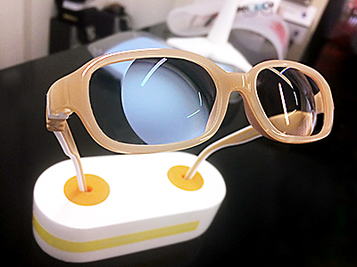 Изготовление очков для ребенка 3-х лет с отсутствием хрусталика и врожденной катарактой